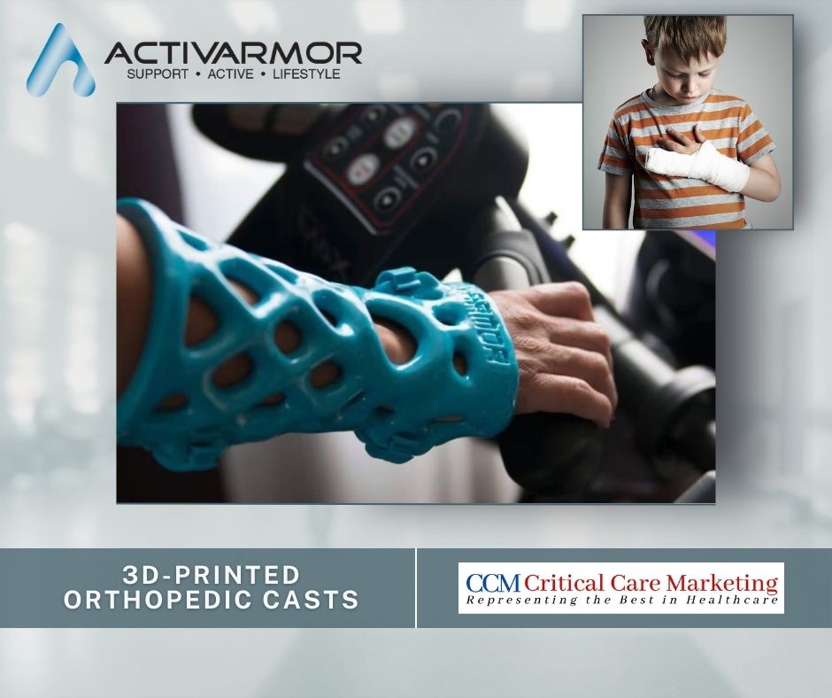 Traditional casts vs. 3D-printed casts